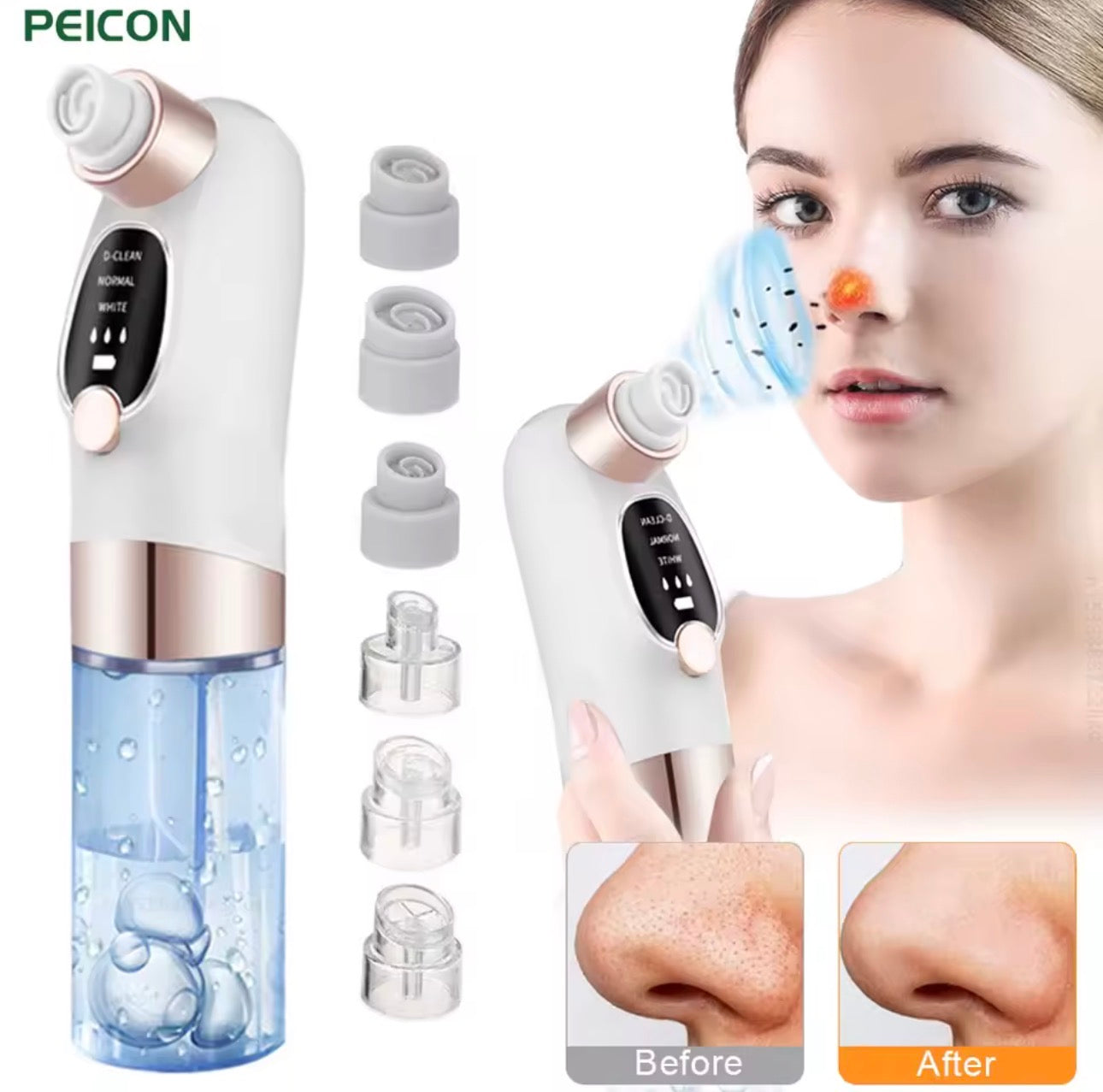 Remove Blackheads in Minutes – Powerful Pore Vacuum Cleaner