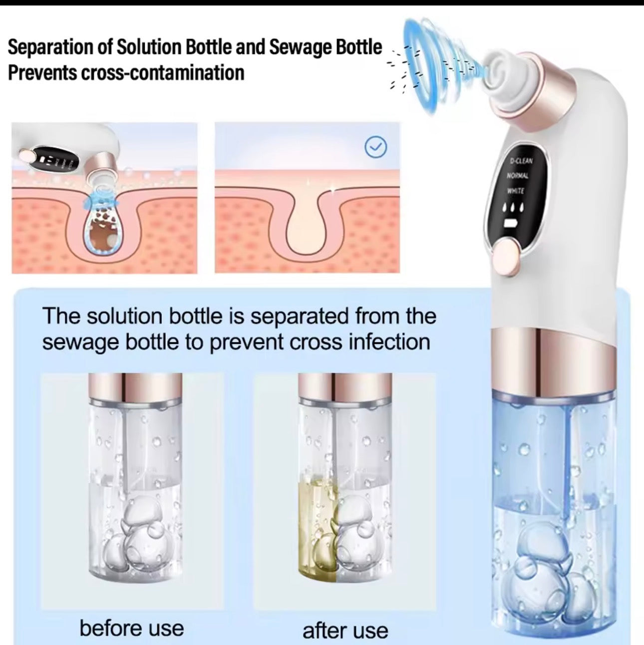 Remove Blackheads in Minutes – Powerful Pore Vacuum Cleaner