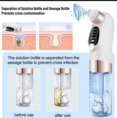 Remove Blackheads in Minutes – Powerful Pore Vacuum Cleaner